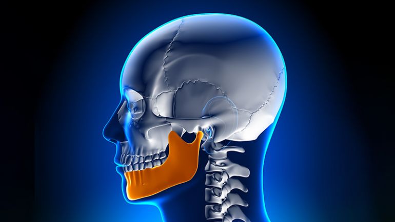 Bruxismo ATM en Pinto